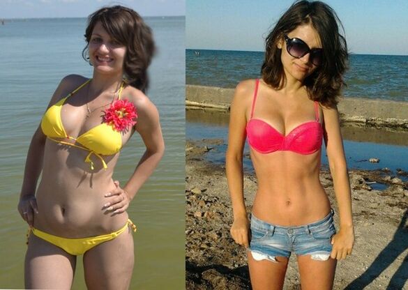 Anna je z NexaSlim izgubila 10 kg